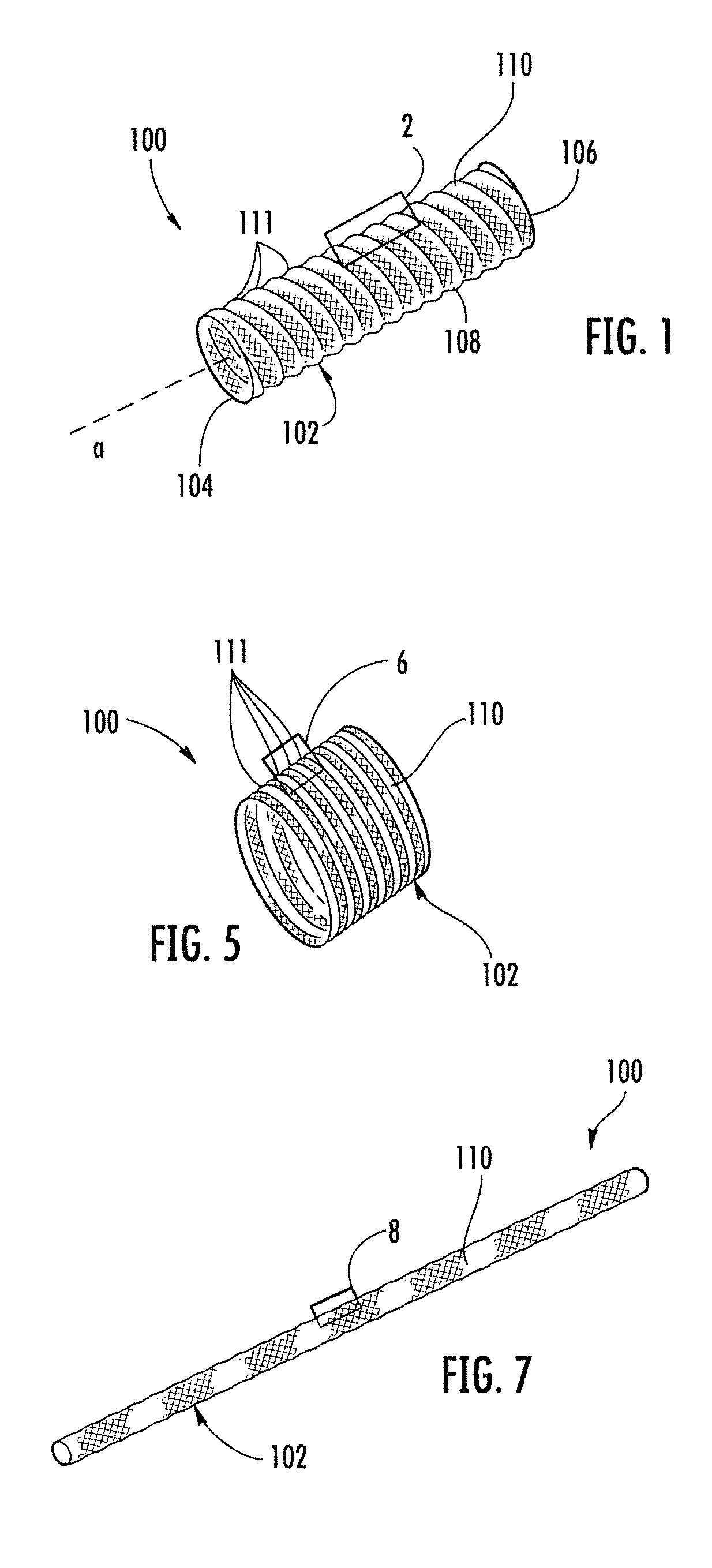 Medical device including corrugated braid and associated method