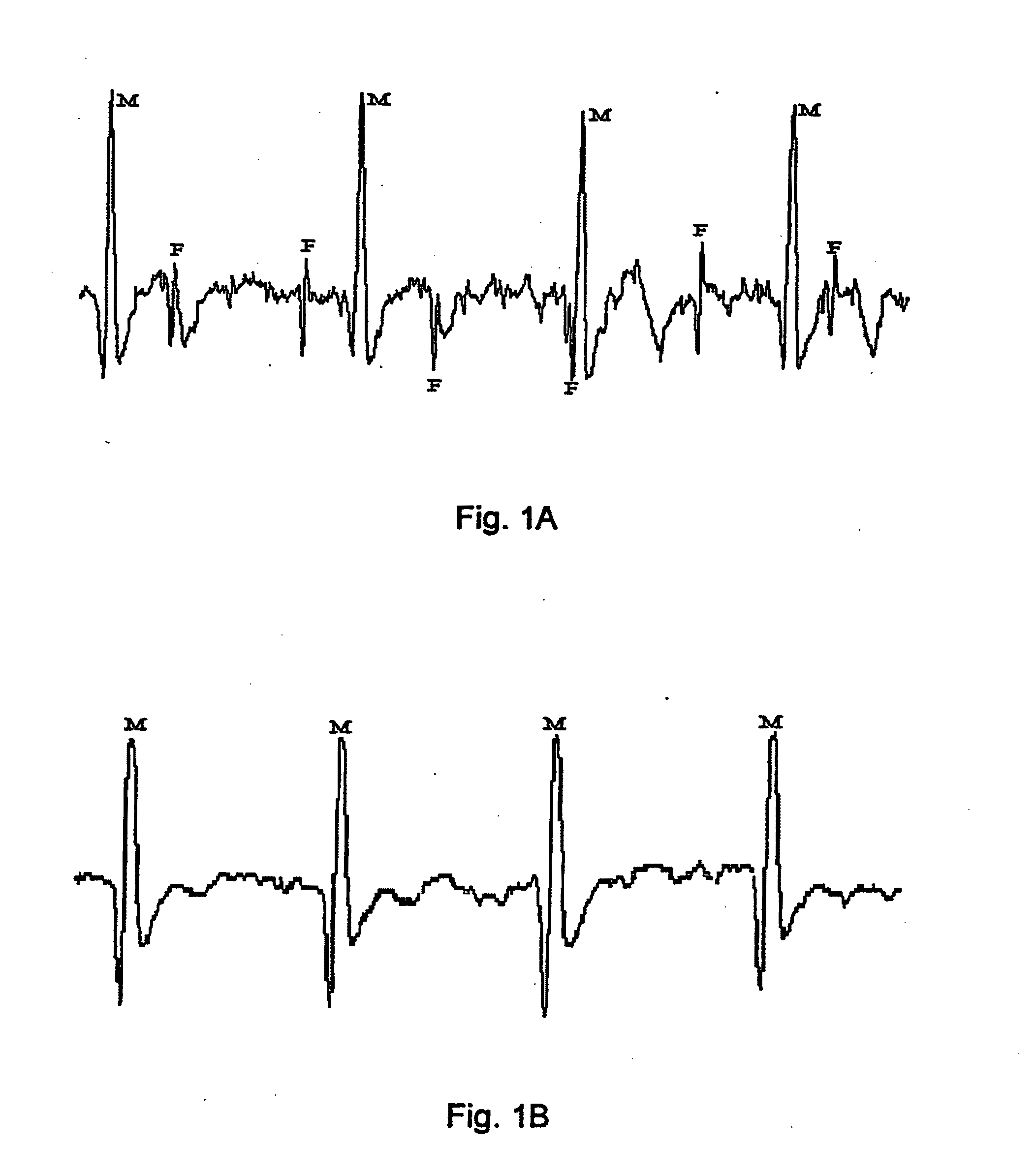 Apparatus and method for detecting a fetal heart rate