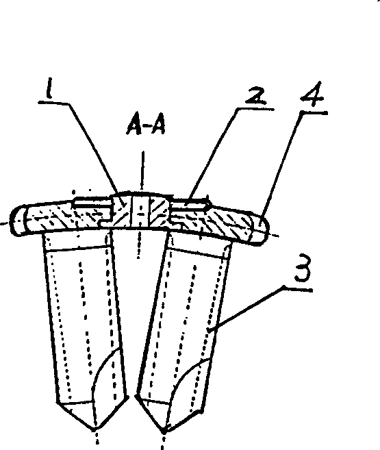 Cervical front-side sheet steel bone screw anti-releasing device