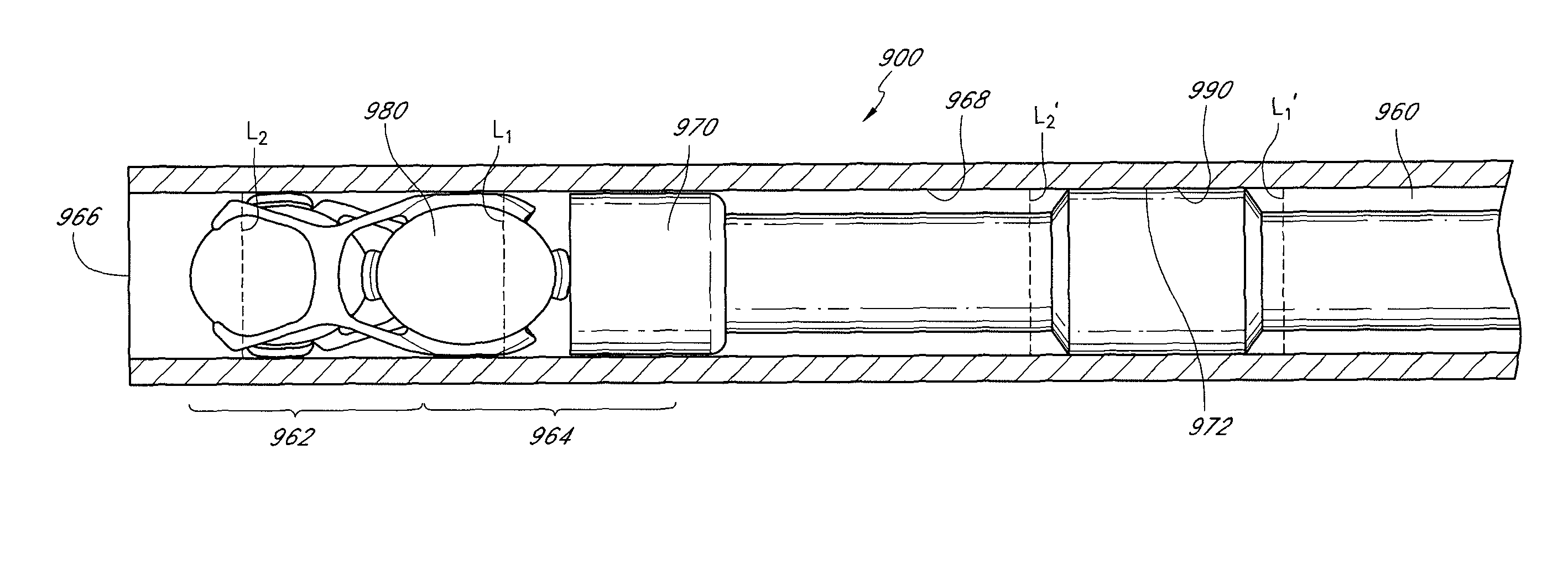 Method for inserting an intraocular lens