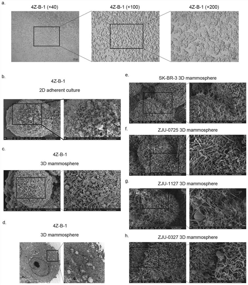 Human breast cancer pleural effusion metastasis cell line and its application