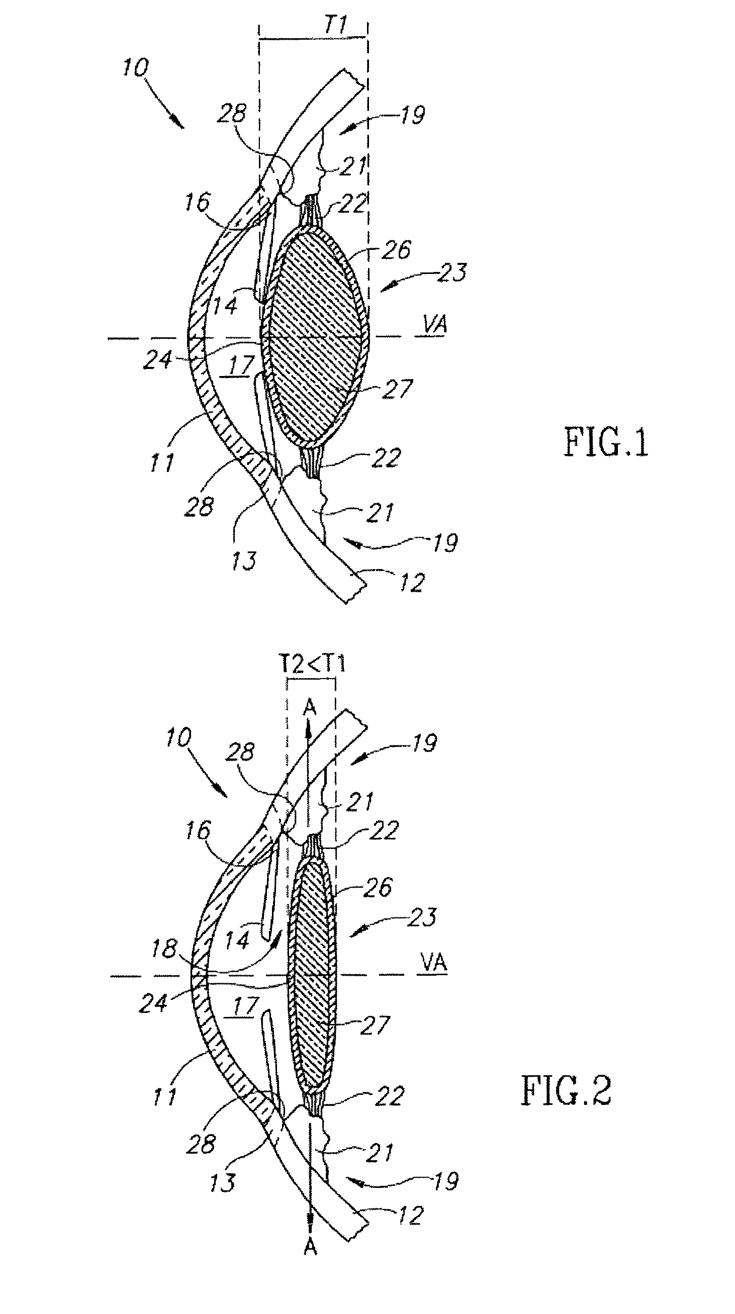 Accommodating intraocular lens (AIOL), and AIOL assemblies including same