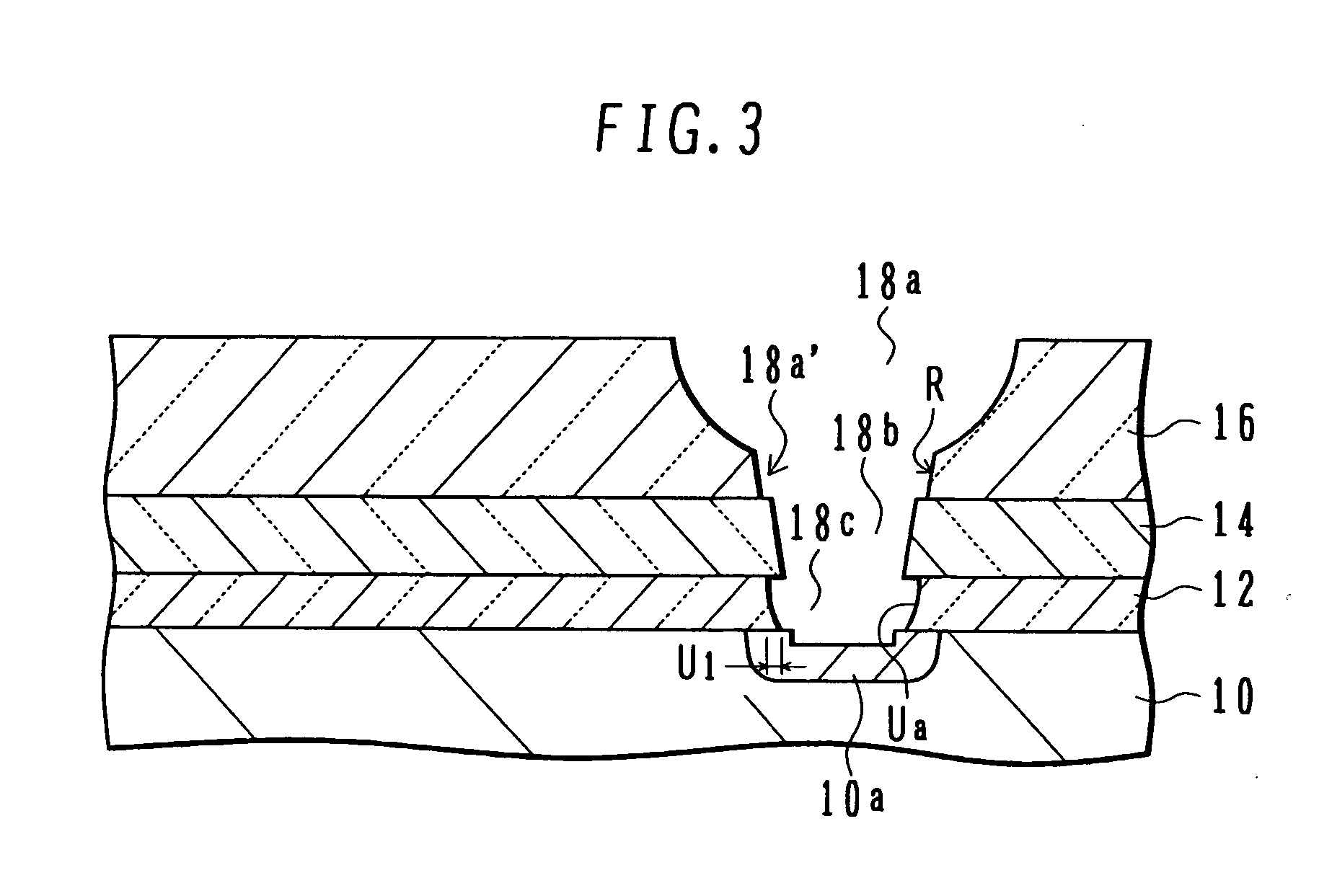 Micro structure with interlock configuration