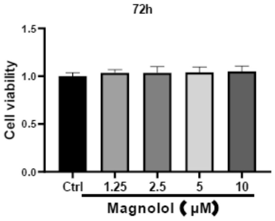 Application of magnolol to preparation of drug for preventing and/or treating myelitis