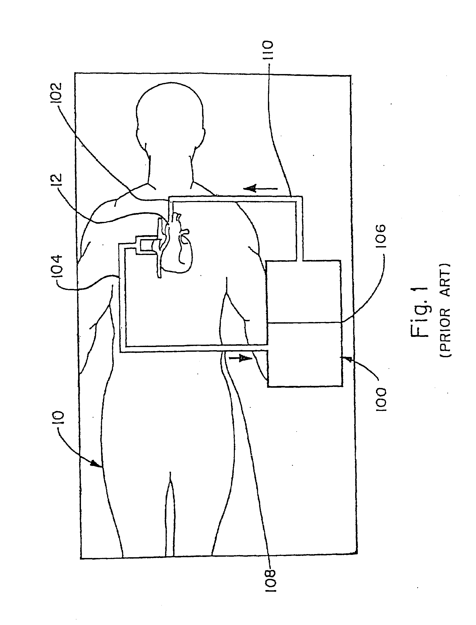 CPB System With Dual Function Blood Reservoir