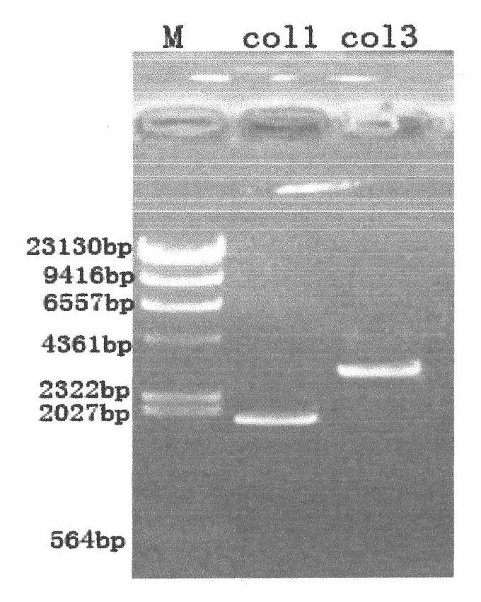 Gene recombination human collagen fusion peptide segment, preparation method and application thereof
