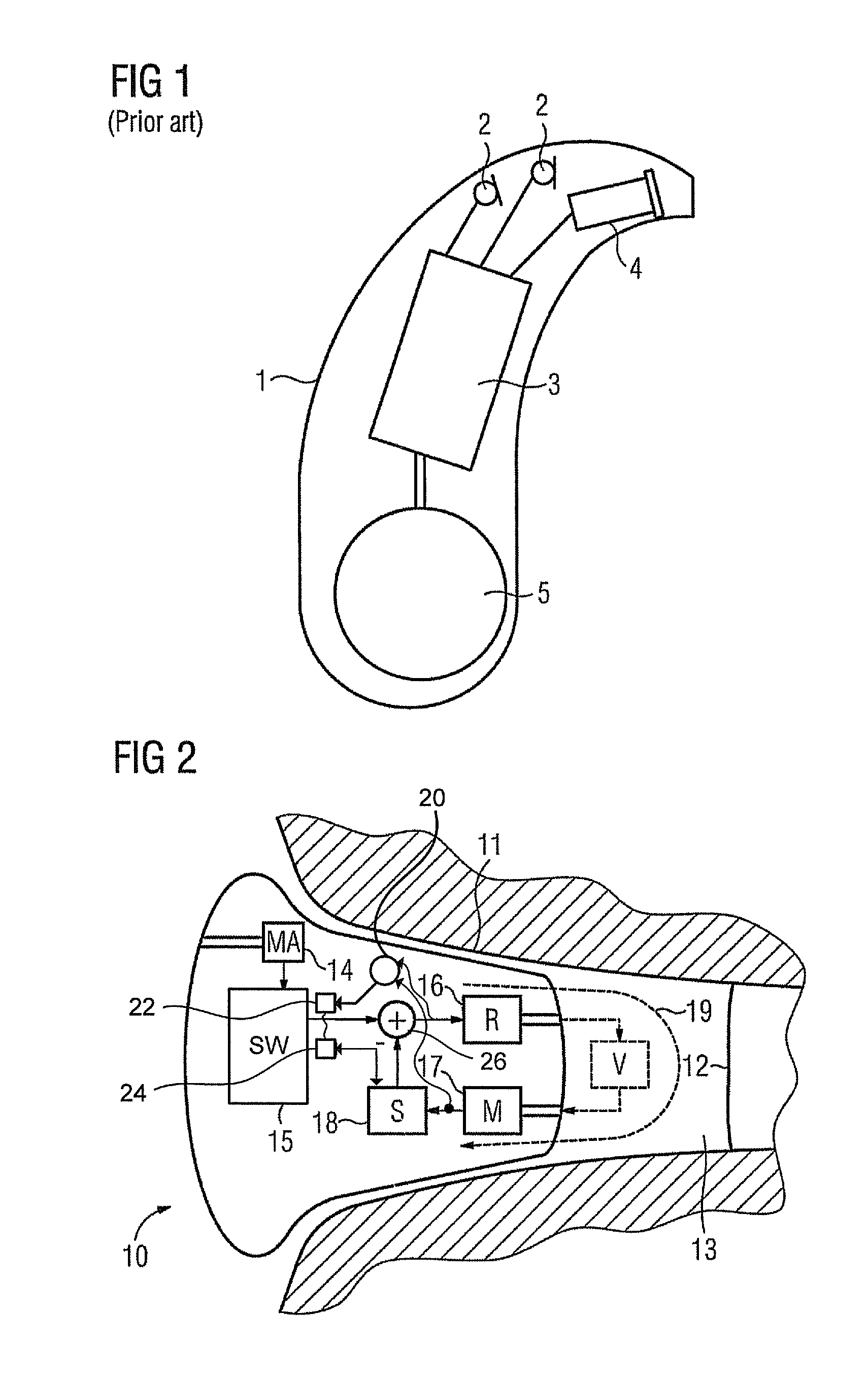 Method for actively reducing occlusion comprising plausibility check and corresponding hearing apparatus