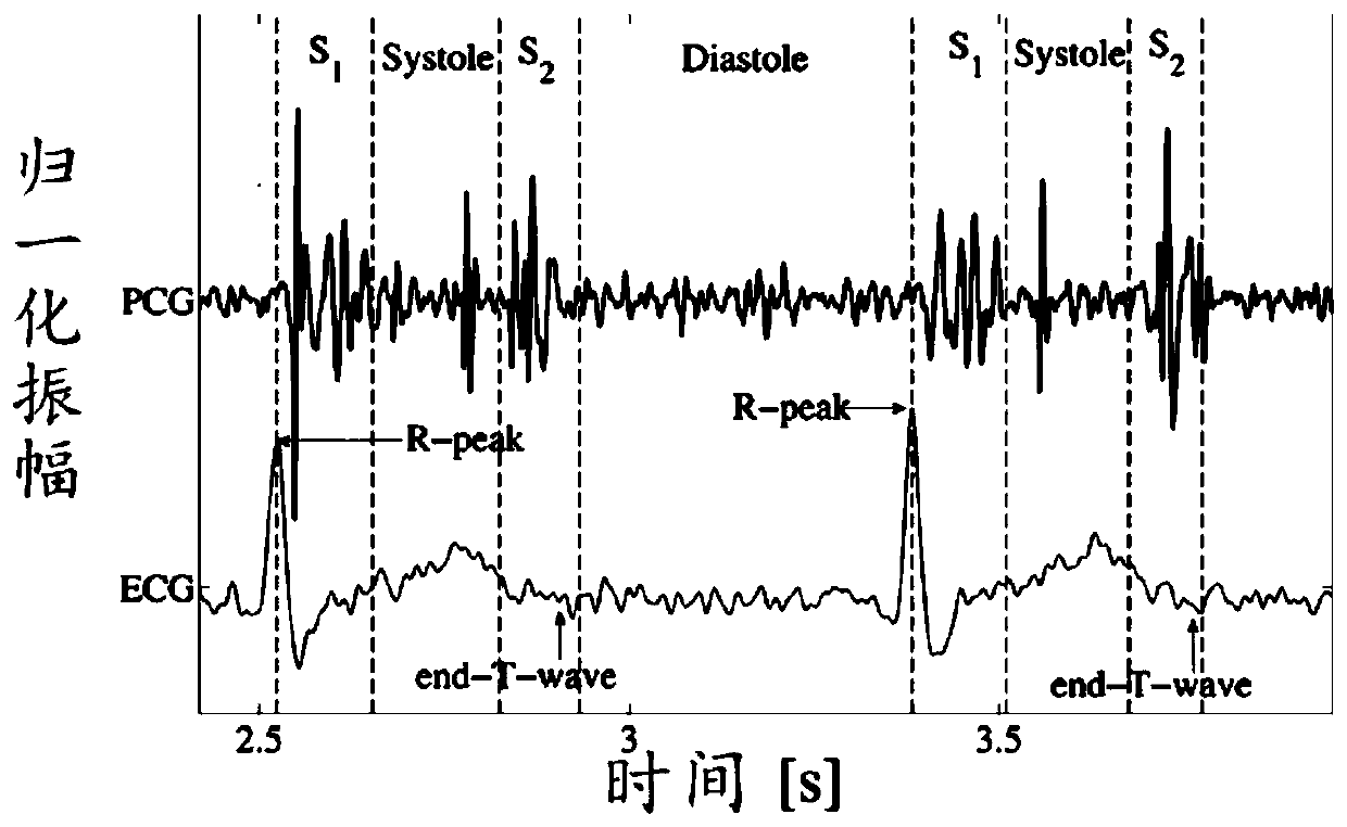 Heart sound classification method and system based on CNN combined with improved frequency wavelet slice transformation