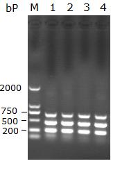 Multi-PCR detection kit and detection method for duck-origin common bacteria