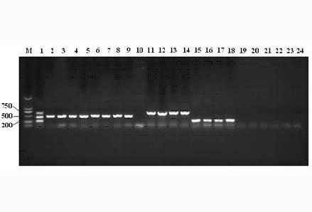 Multi-PCR detection kit and detection method for duck-origin common bacteria