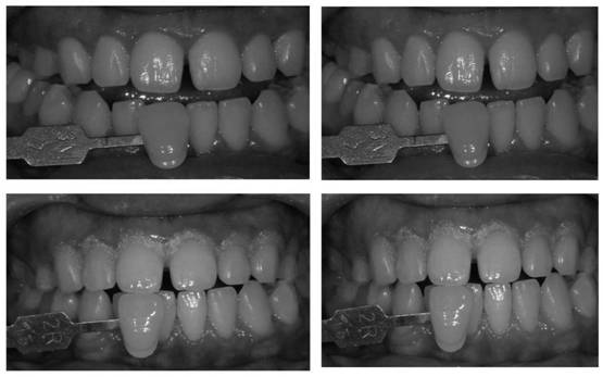 Dental mineralization and bleaching double-functional paste, preparation method and application