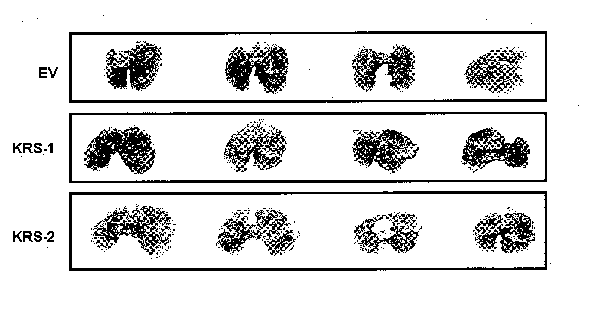 Method for controlling cancer metastasis or cancer cell migration by modulating the cellular level of lysyl trna synthetase