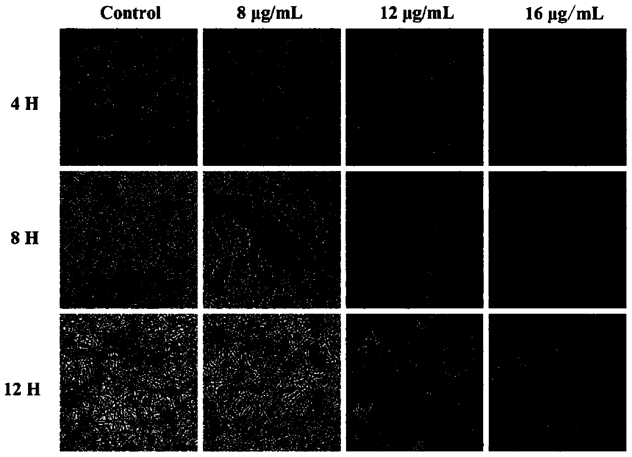 Application of kalopanax saponin A in preparation of anti-candida albicans drugs, drug preparation of kalopanax saponin A, and drug preparation for diseases caused by candida albicans