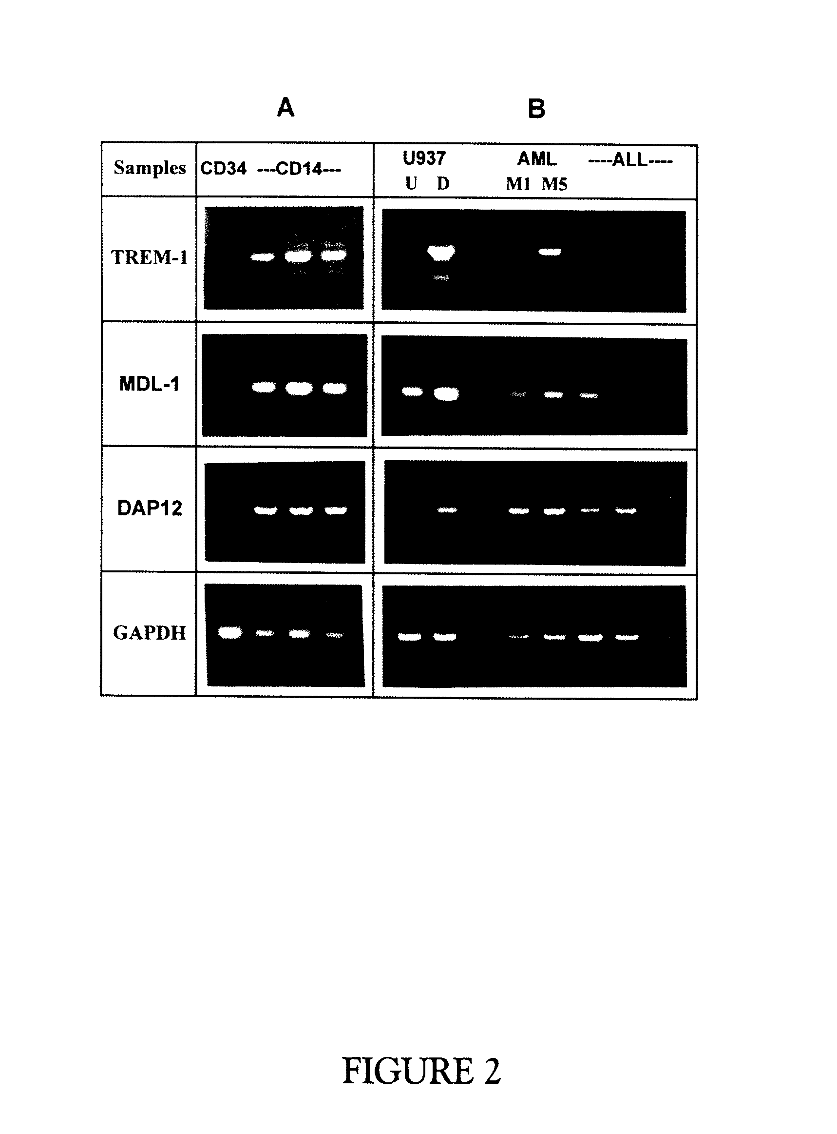 Trem-1 splice variant for use in modifying immune responses