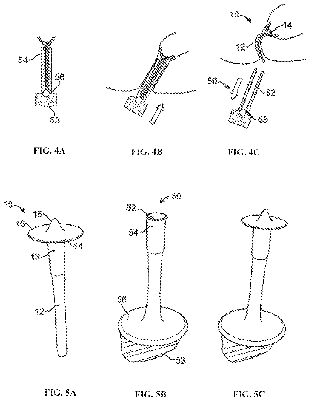 Fecal incontinence device for positioning in the lower rectum