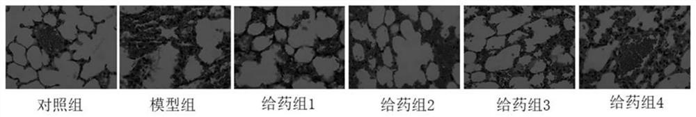 Traditional Chinese medicine composition for preventing and treating endotoxin-mediated acute lung injury and preparation method thereof