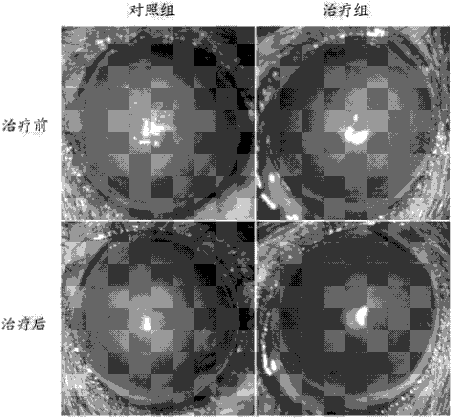 Application of BRD4 inhibitor JQ1 in corneal scar inhibition