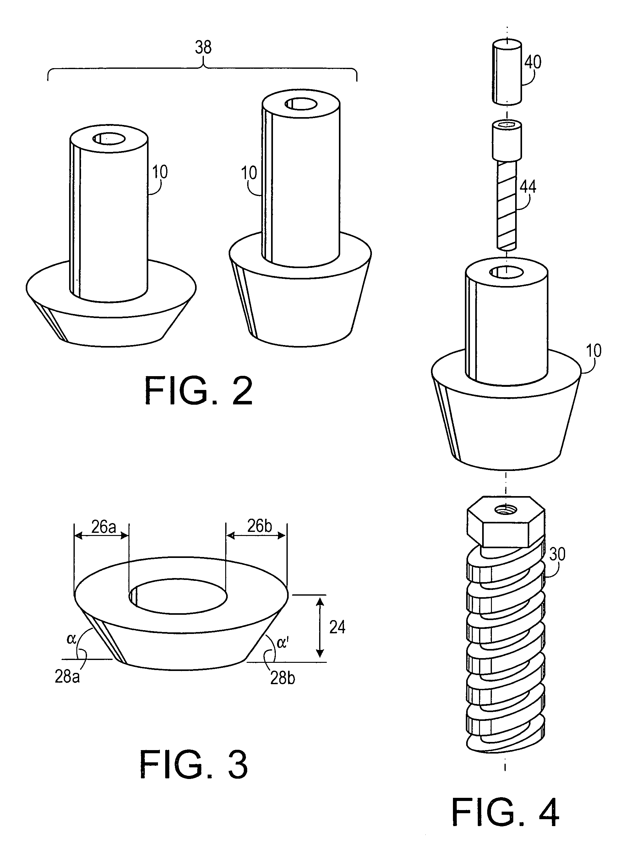 Abutment system and method for preparing the same