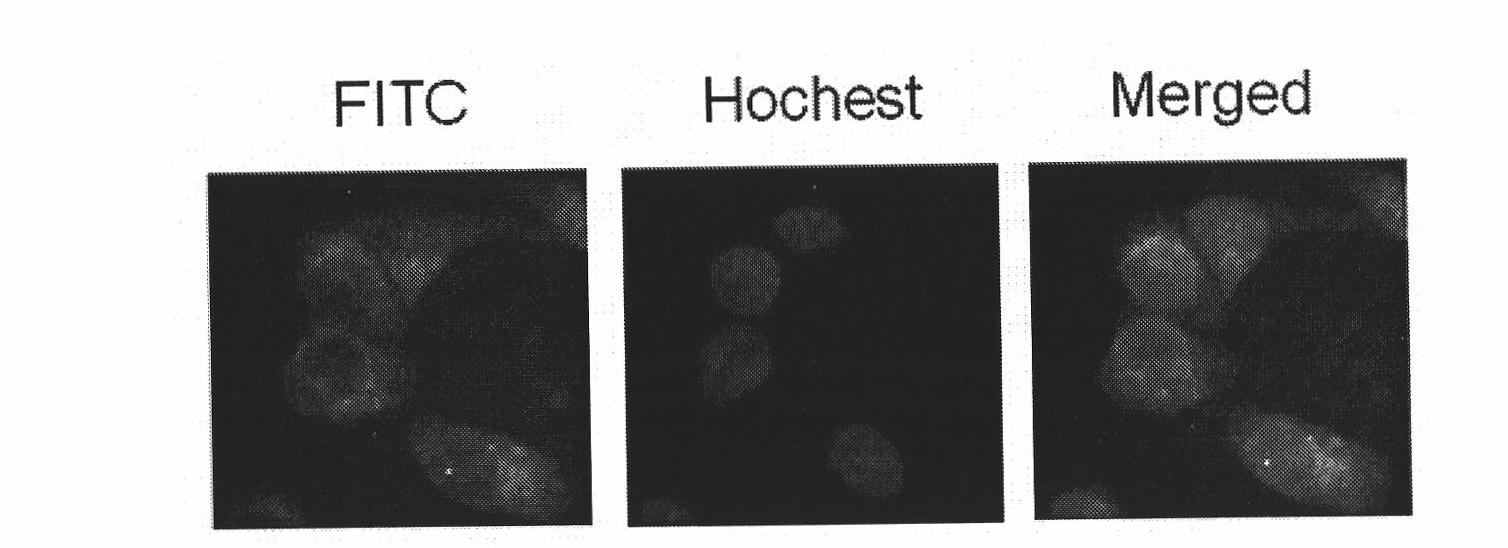 DNA fragment for peculiarly inhibiting Rab27B gene expression and application thereof