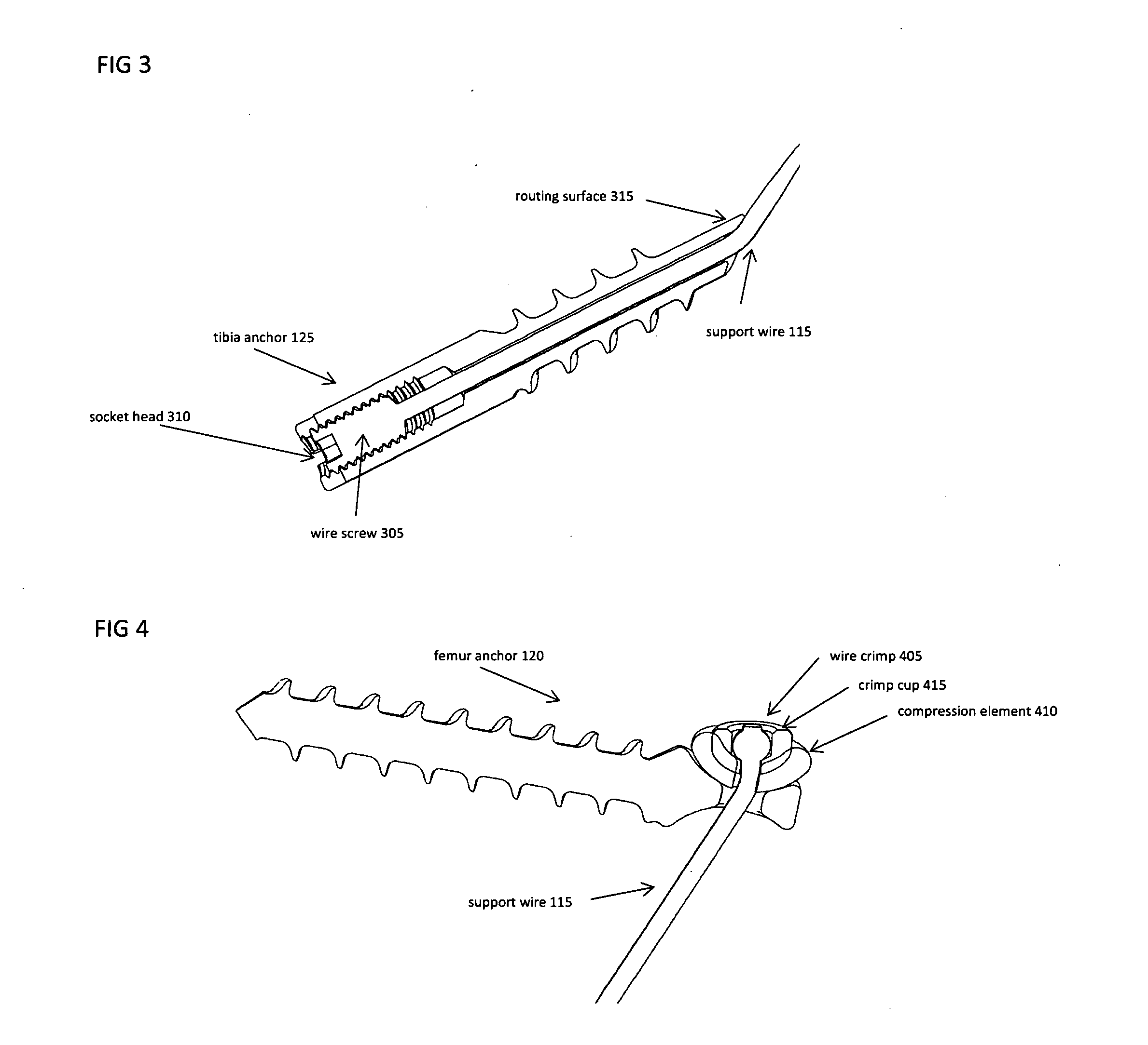 Joint stability device and method