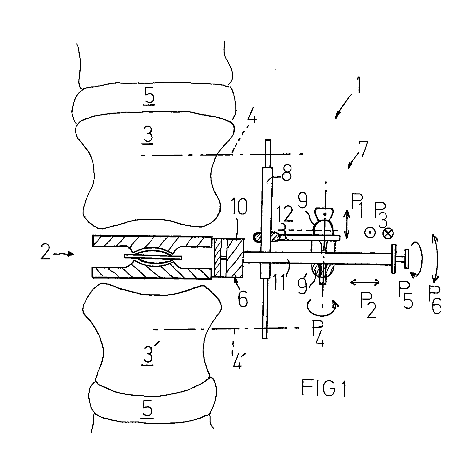 Positioning Device for a Prosthesis Device and System Therefore