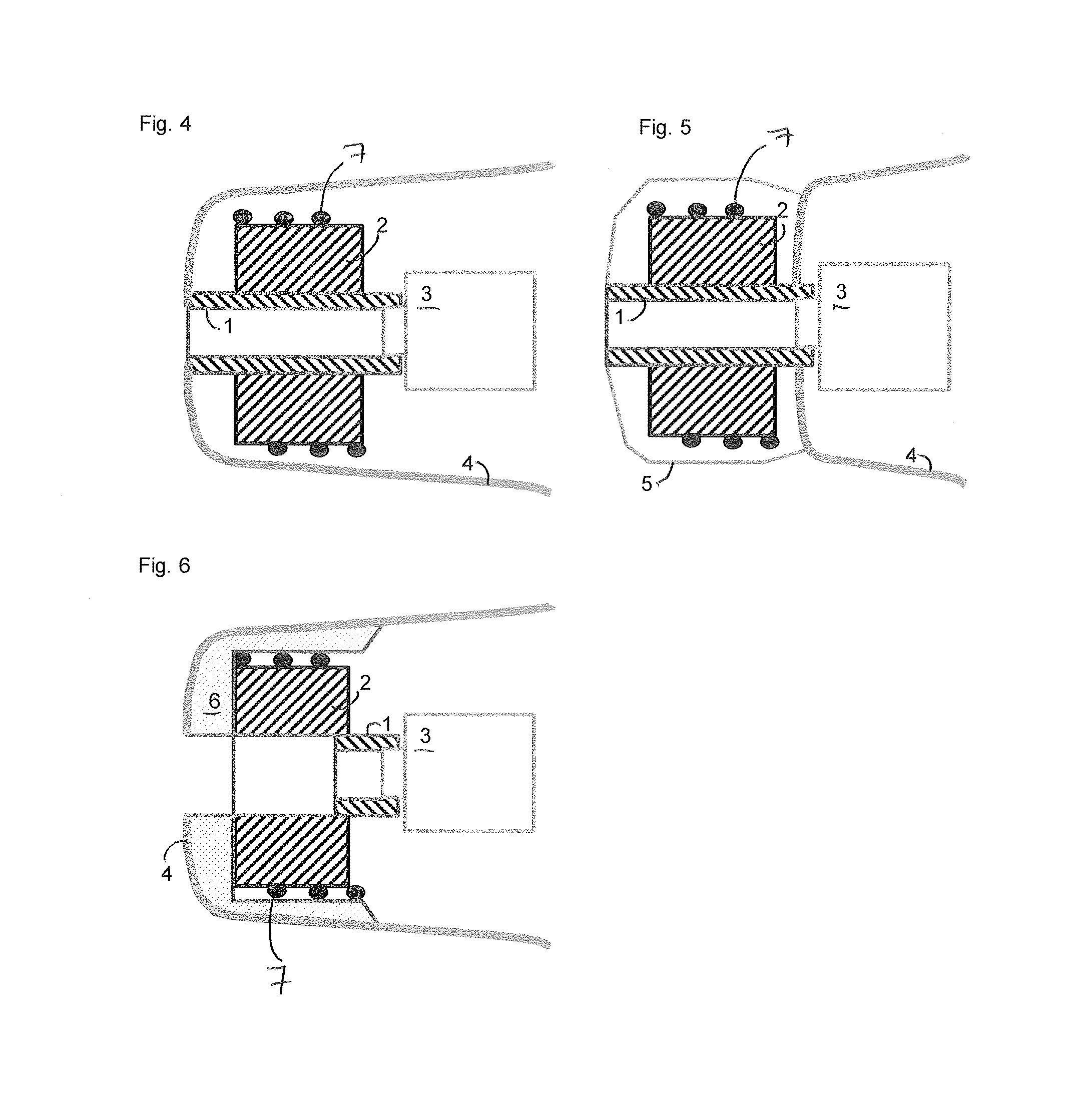 Antenna for hearing device, ear tip and hearing device provided with such an antenna