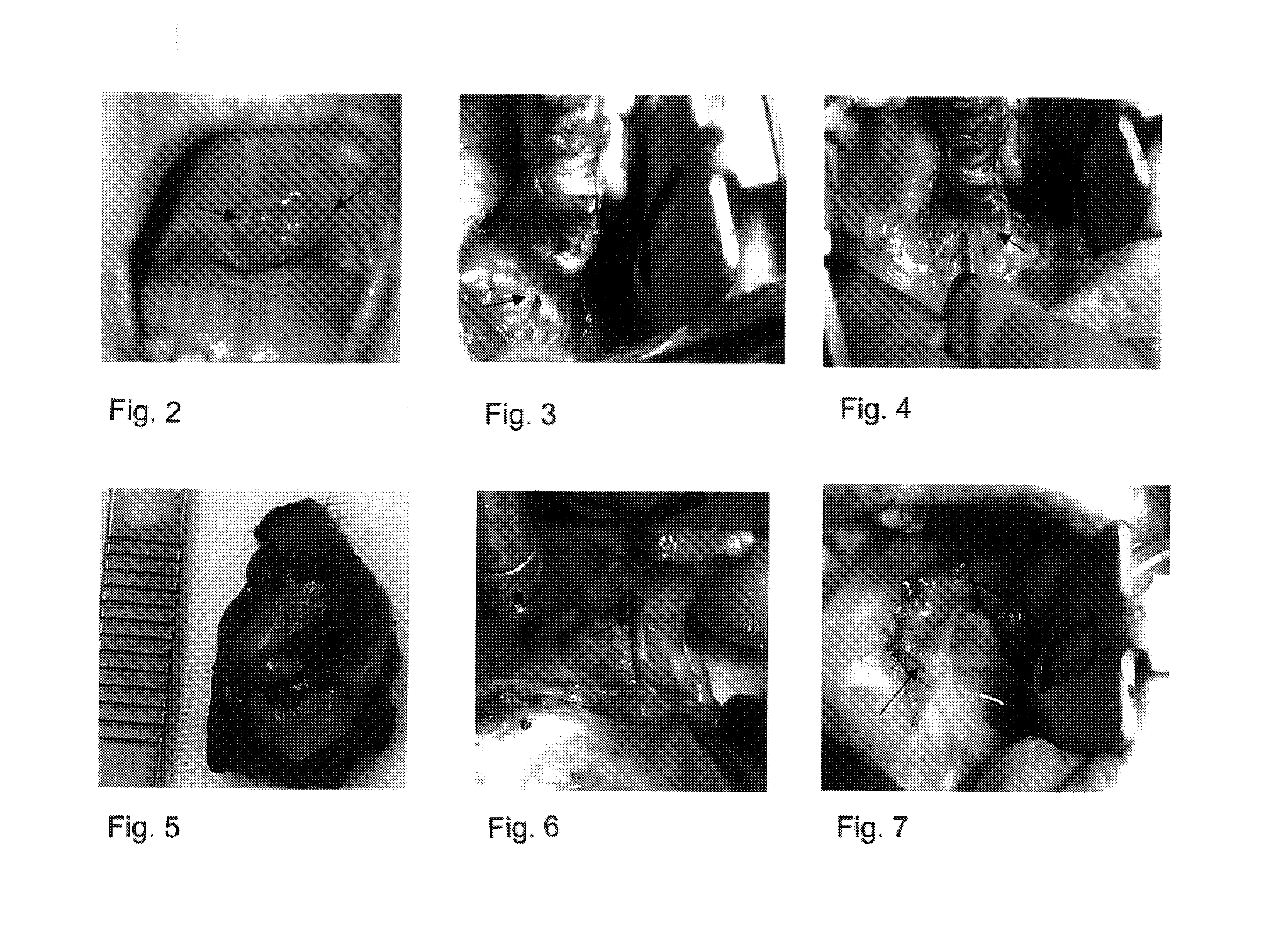 Silver alloys for use in medical, surgical and microsurgical instruments and process for producing the alloys