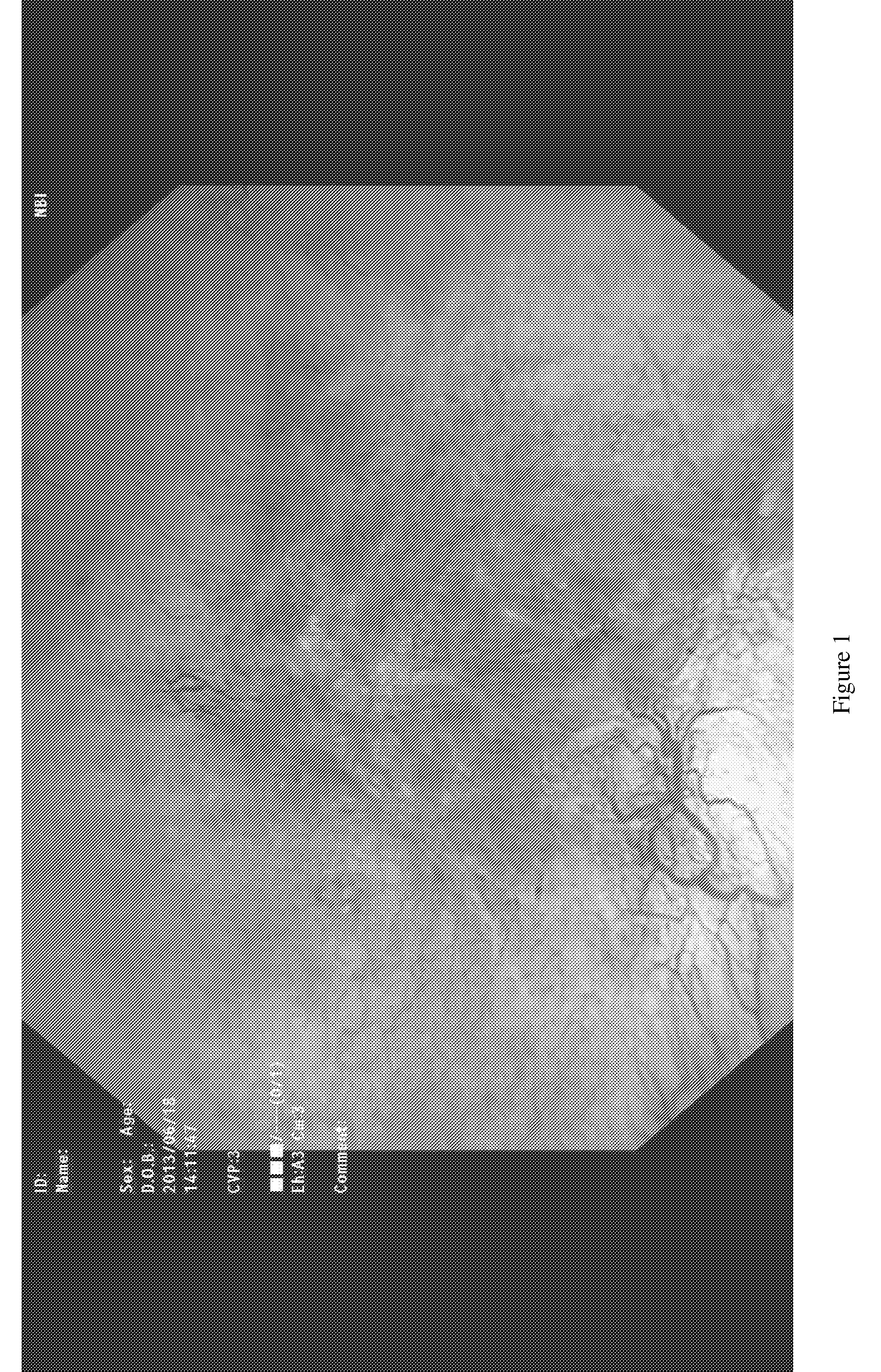 Therapeutic agent for lower urinary tract disease