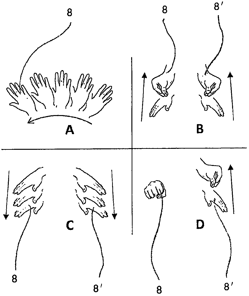 Controls for medical equipment