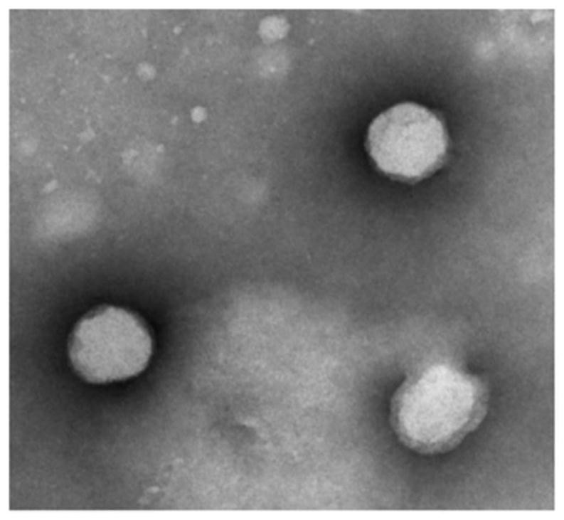 Squalene chidamide prodrug self-assembled nanoparticles, and preparation method and application thereof