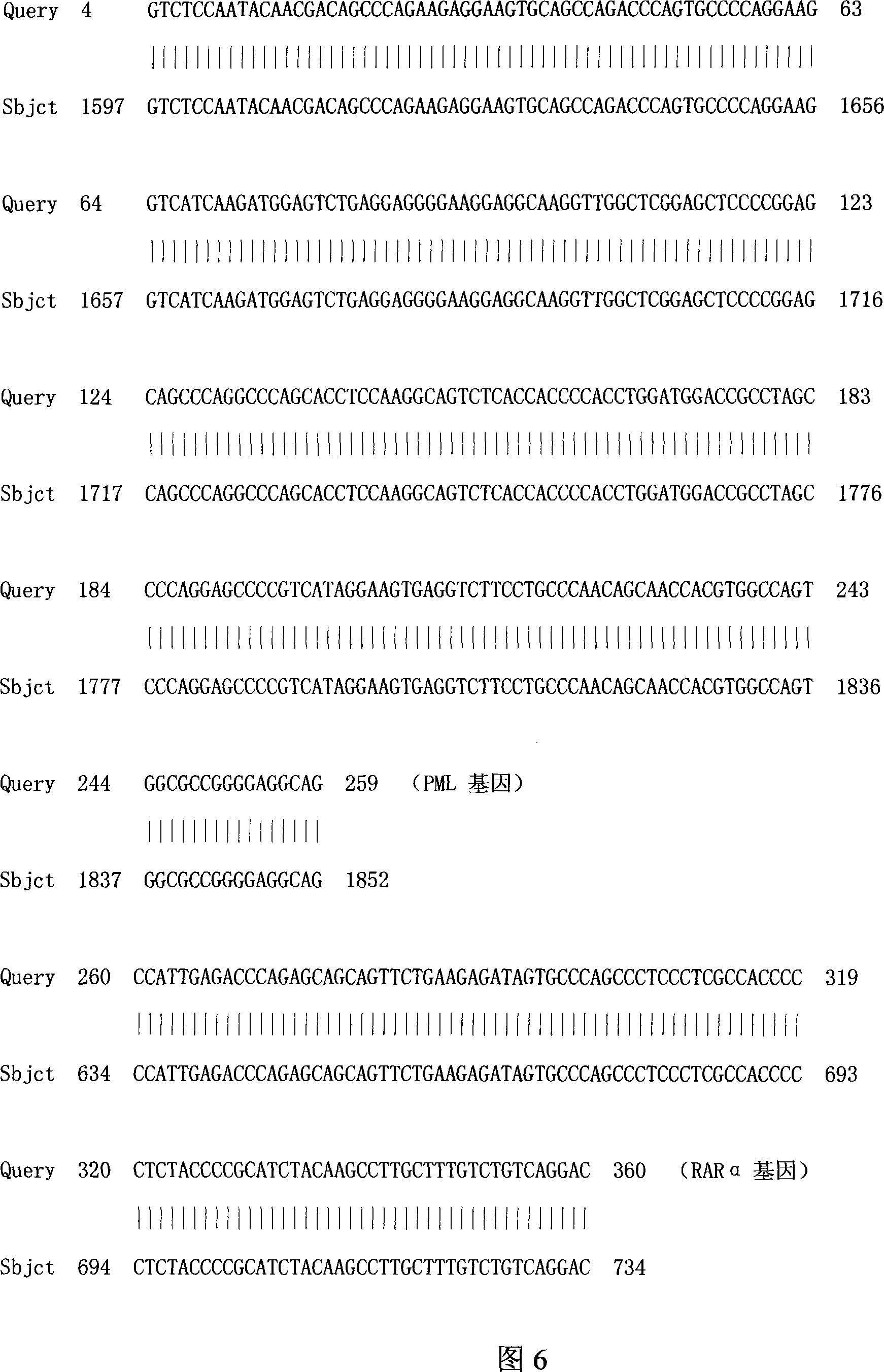 Acute progranulocyte leukemia DNA vaccine PML-RAR alpha 384-hIL-2 and preparing method and application thereof