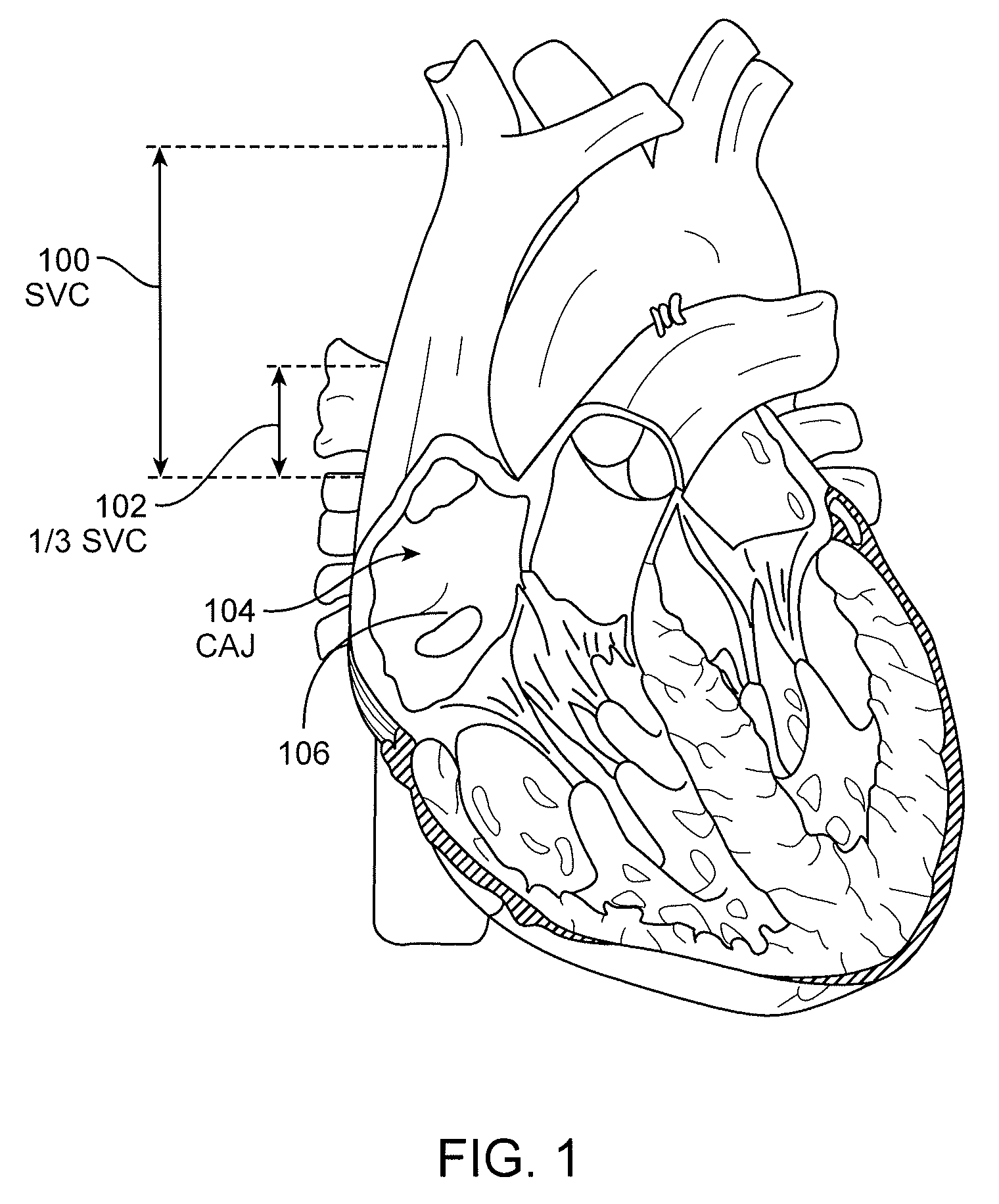 Systems and methods for detection of the superior vena cava area