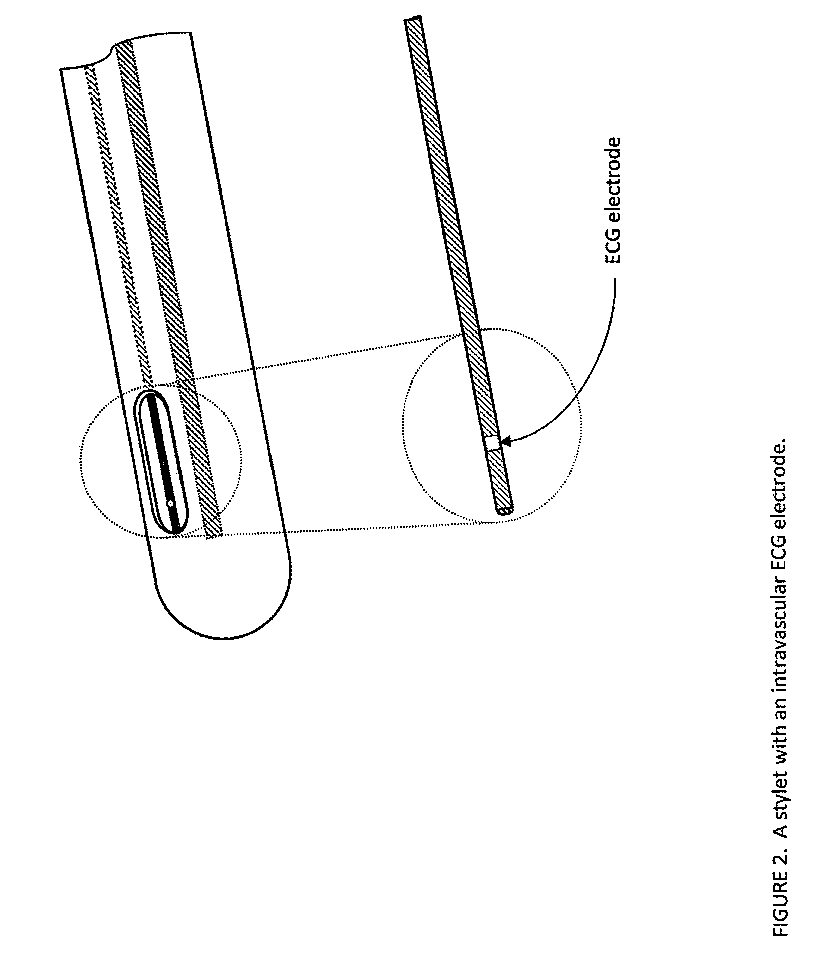 Systems and methods for detection of the superior vena cava area