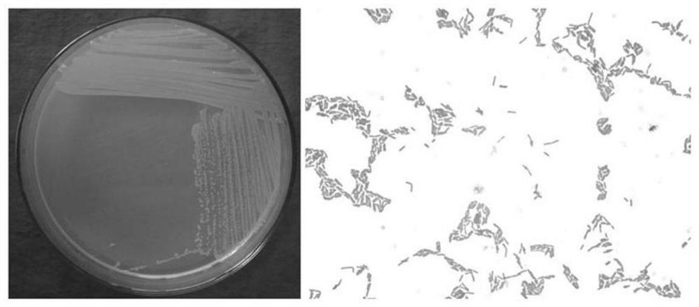 An antagonistic bacteria z-18 for controlling cotton verticillium wilt and its application