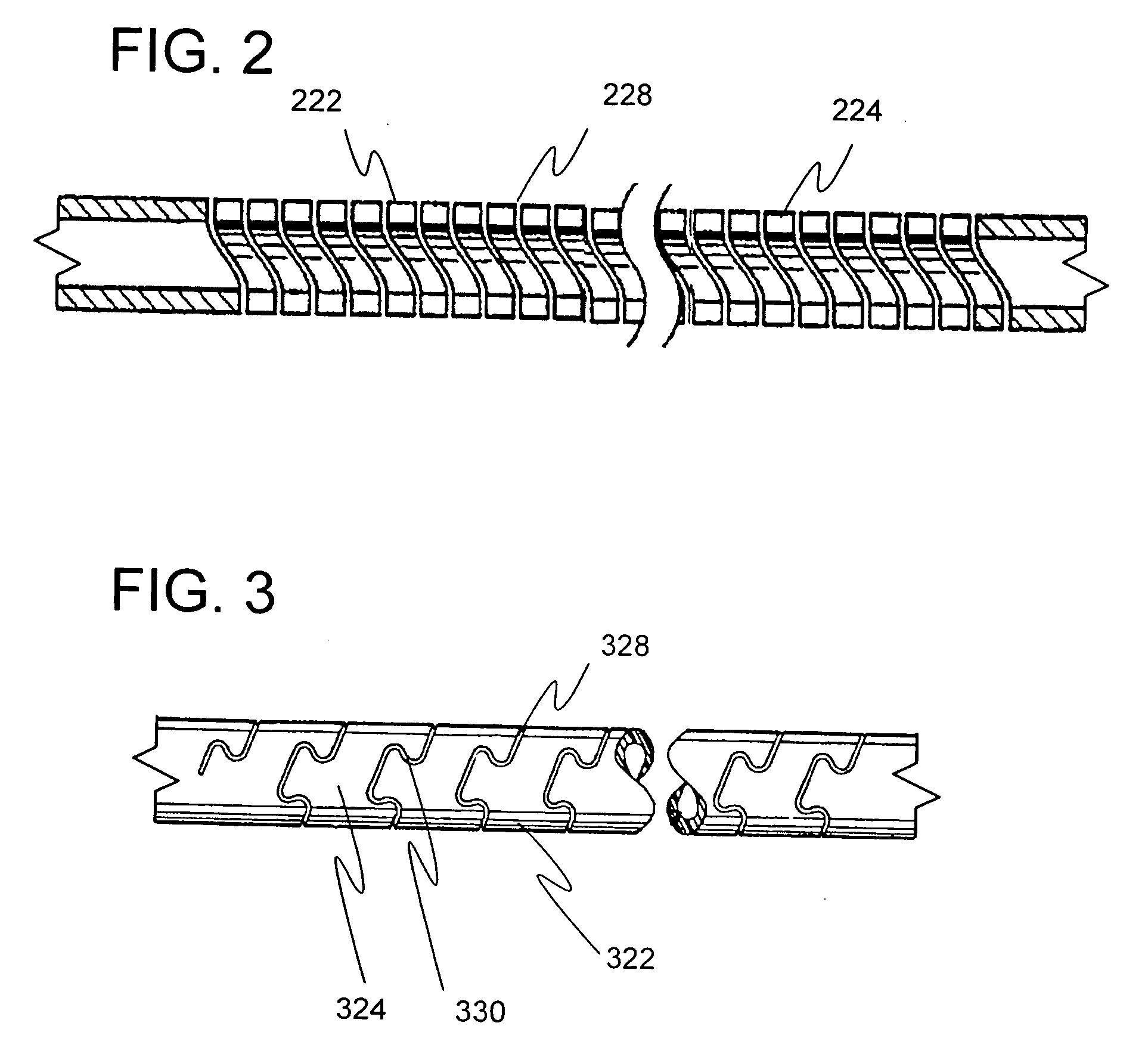 Flexible trephine and method of removing a bowed implant from a bone