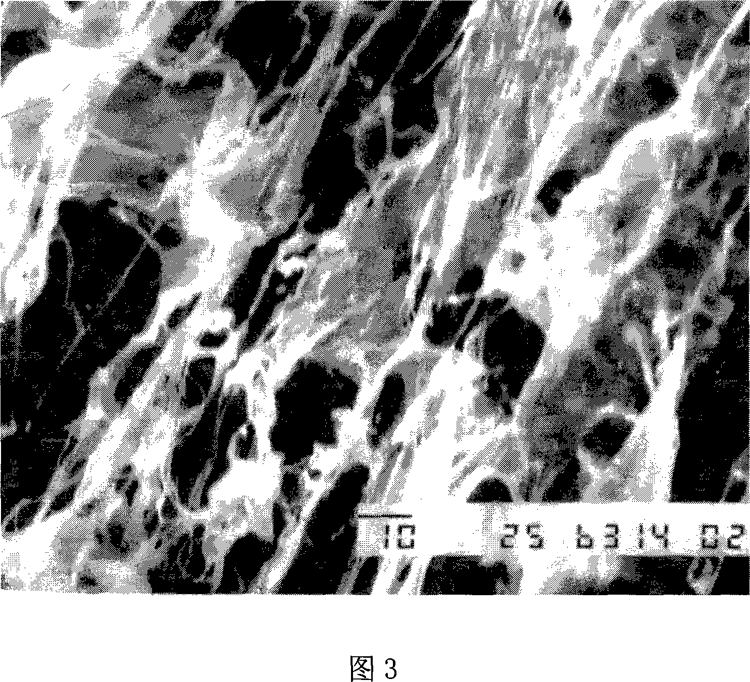 Method for fixing chitosan enzyme by using cross-linking adsorption of chitosan - glutaraldehyde