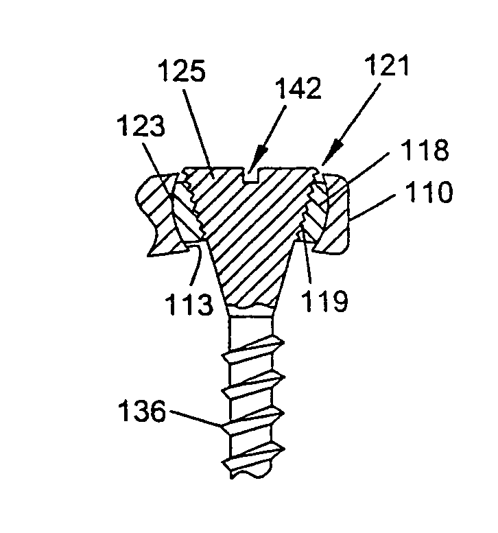 System and method for stabilizing the human spine with a bone plate