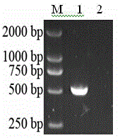Indirect ELISA (enzyme-linked immunosorbent assay) detection kit based on toxoplasma gondii matrix protein 1