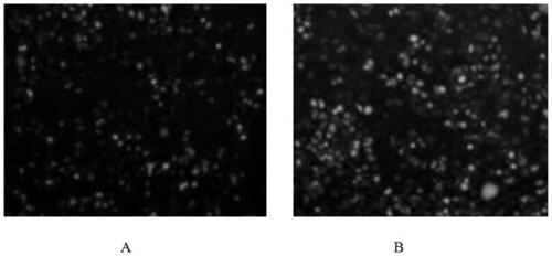 A co-loaded super deformable liposome targeting anti-squamous cell carcinoma of the skin and its preparation method and application