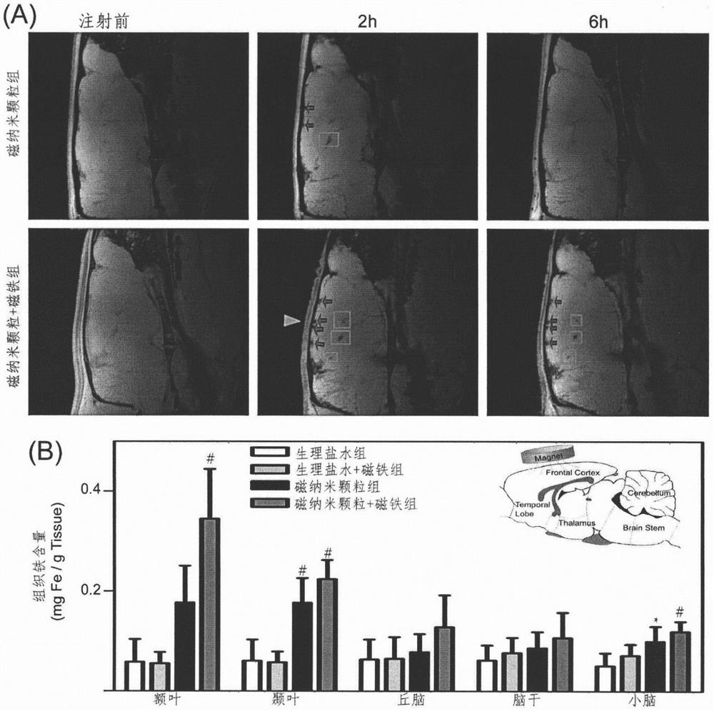 Technology for enhancing brain magnetic therapy effect by magnetic nanomaterial