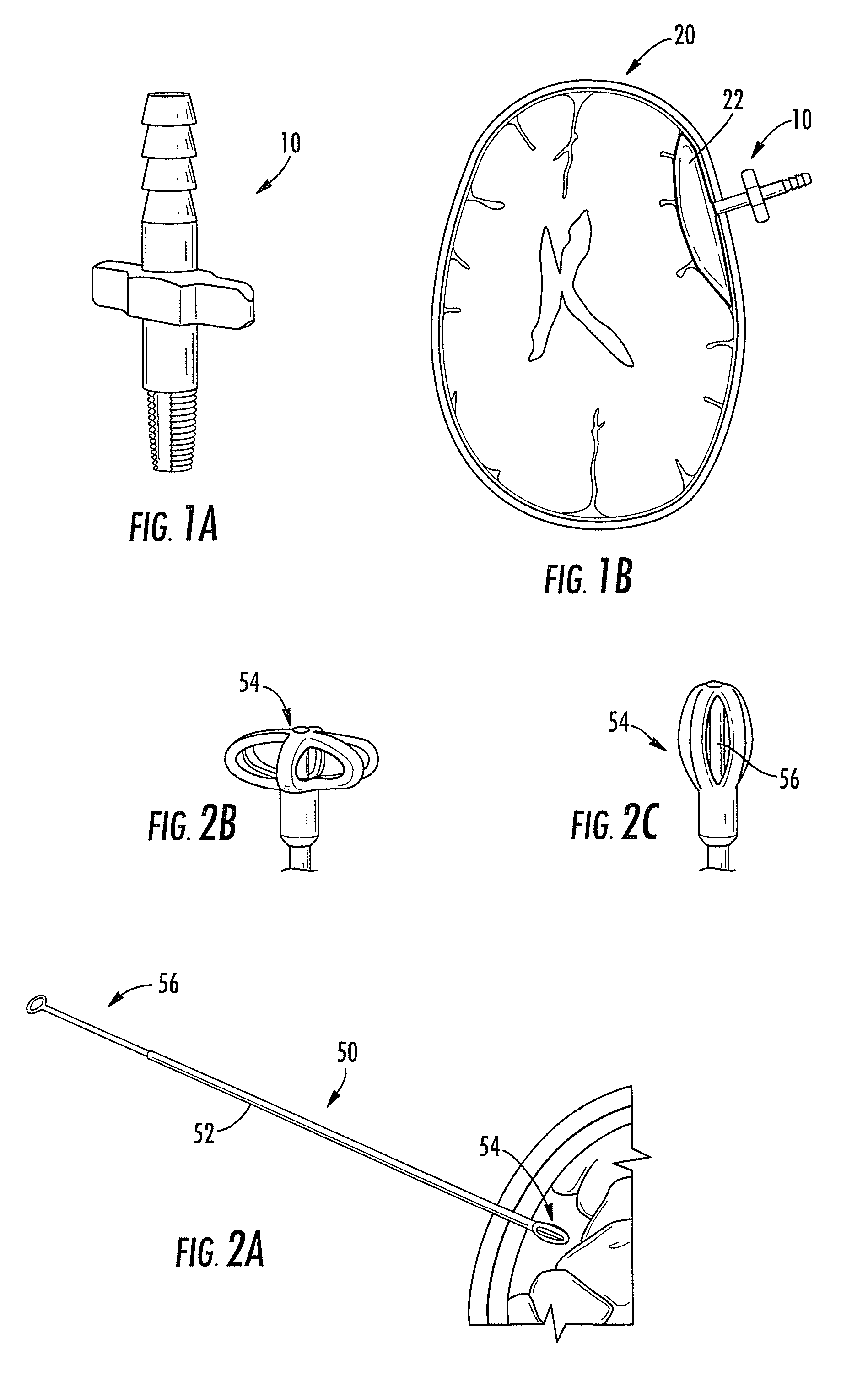 Subdural Drainage Catheter with Flow Restoration Mechanism