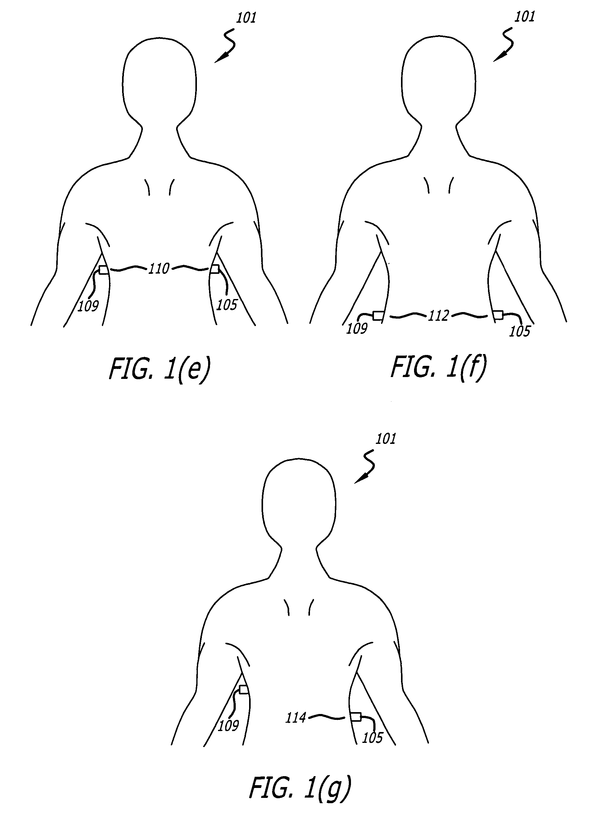 Vantilation and volume change measurements using permanent magnet and magnet sensor affixed to body
