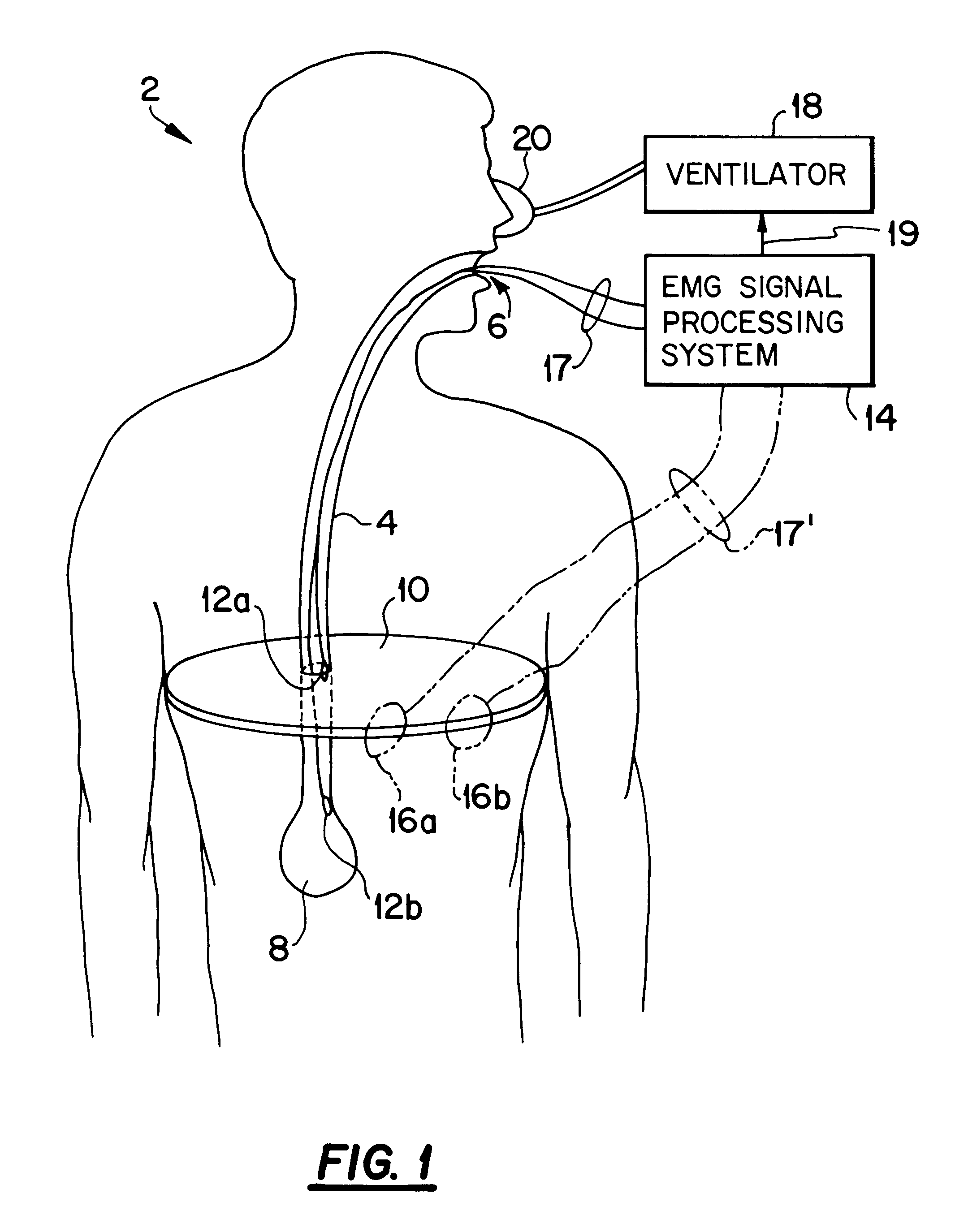 Method and apparatus for producing a model EMG signal from a measured EMG signal