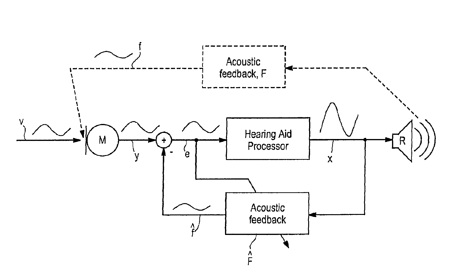 Hearing aid, and a method for control of adaptation rate in anti-feedback systems for hearing aids