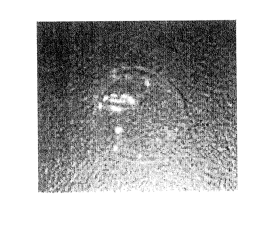 Non-fibrogenesis collagen material and a manufacturing method thereof