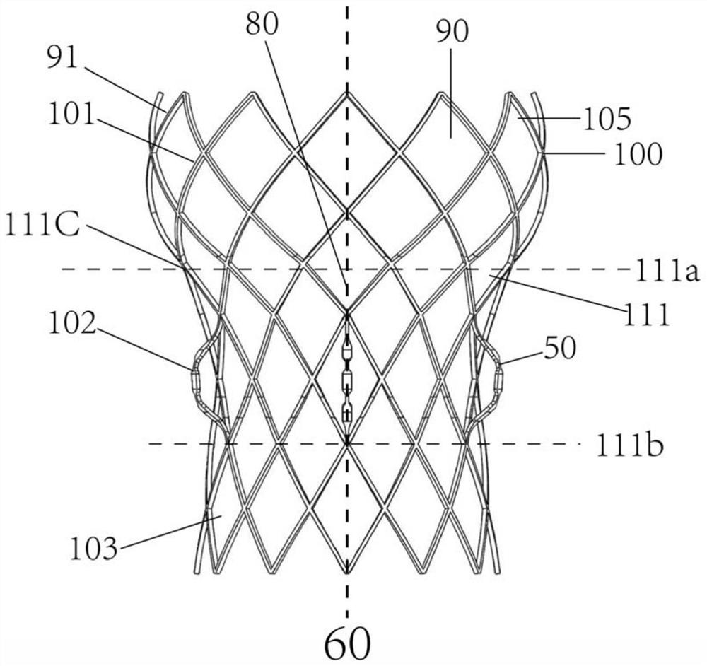 A structure-fit transcatheter aortic valve implantation device