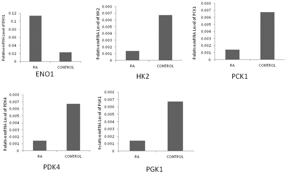 Application of phosphoglycerate kinase 1 in the preparation of diagnostic reagents for rheumatoid arthritis