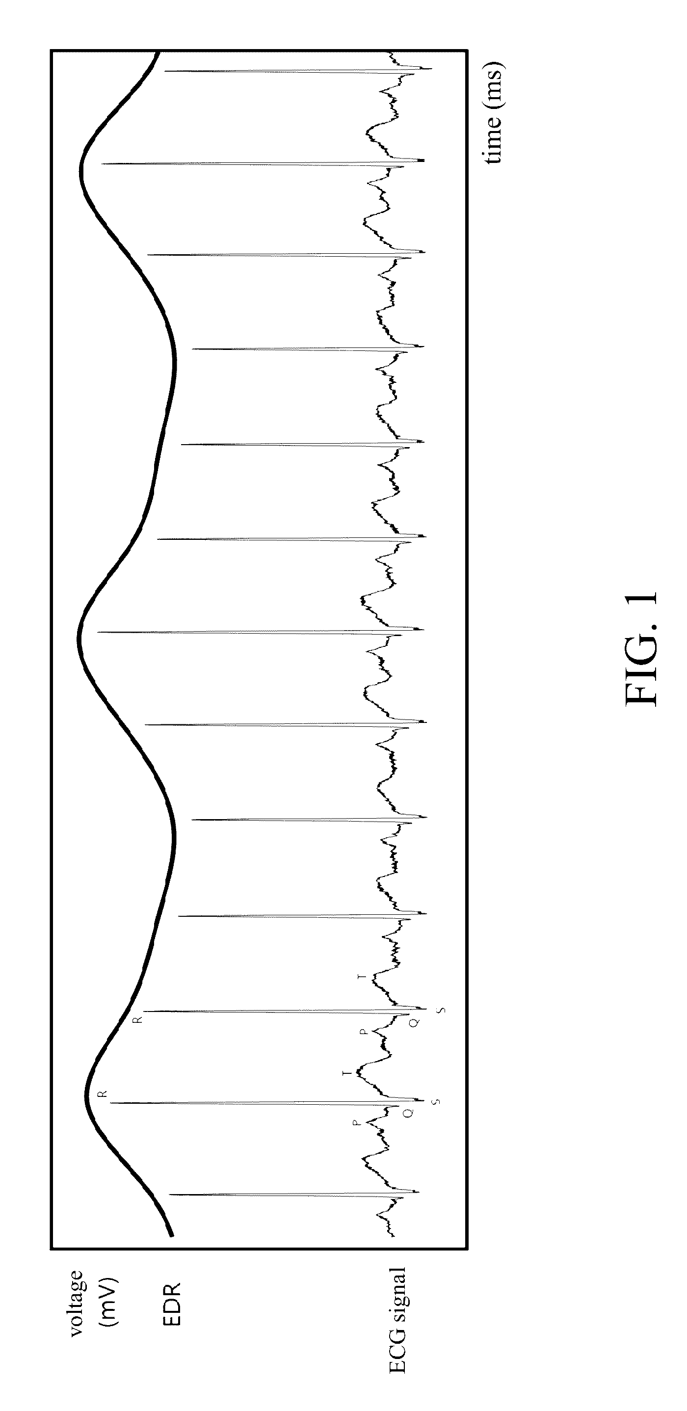 Method and apparatus for estimating depth of anethesia by using ECG signal
