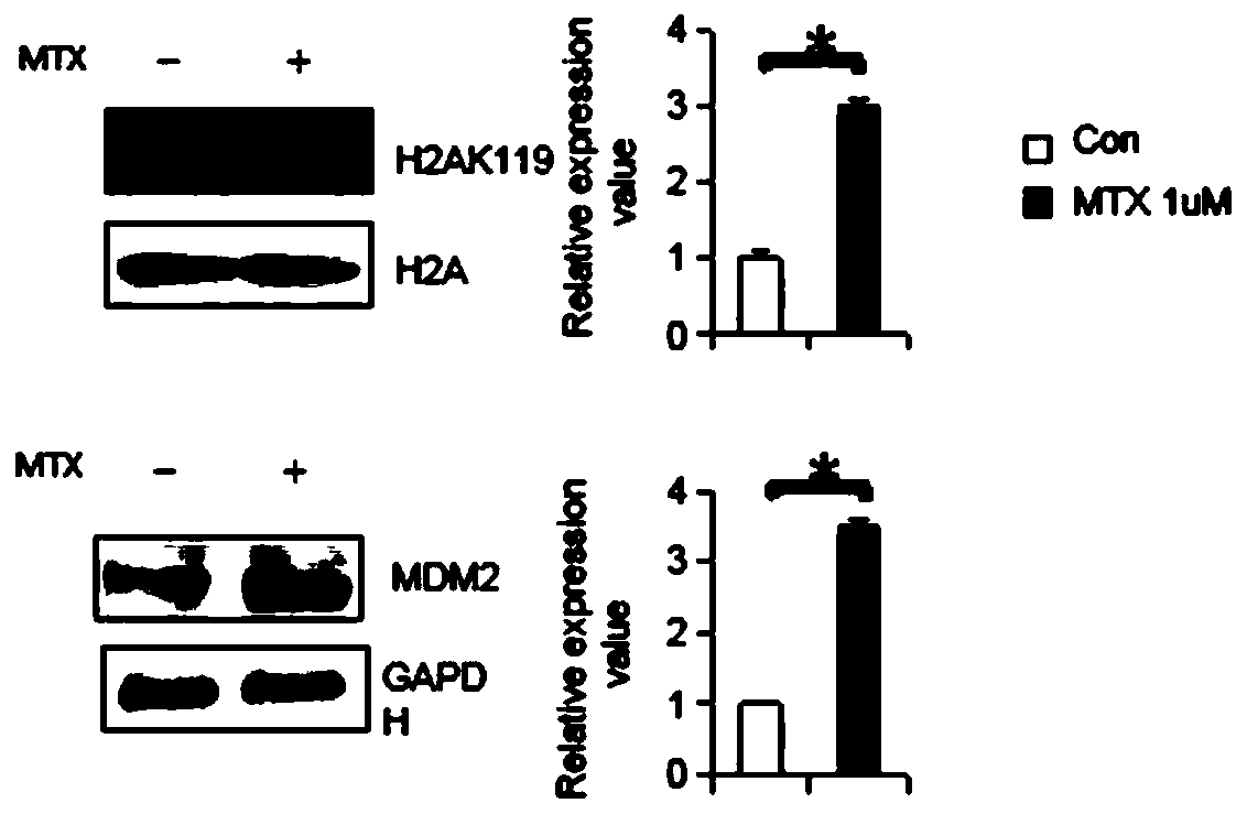 Molecular marker for detecting neural tube malformation and application of marker