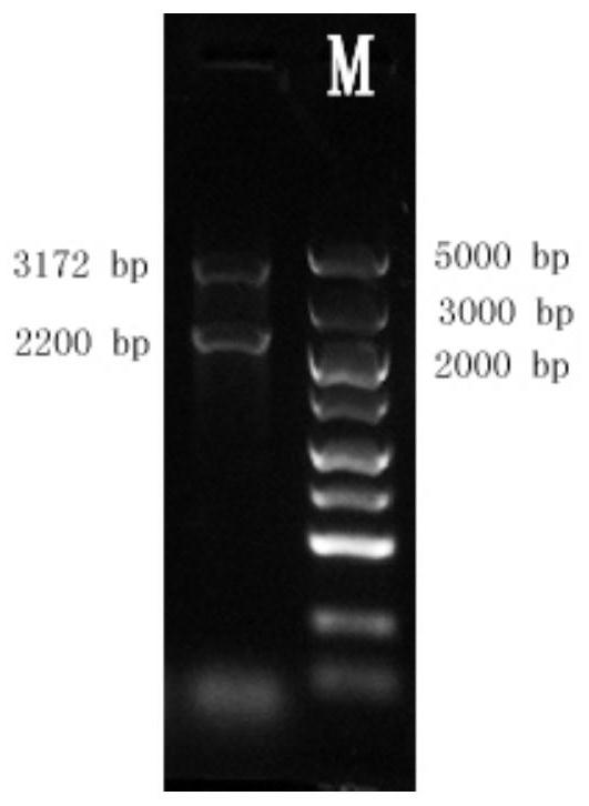 Method for producing recombinant human type II collagen single chain by Pichia pastoris